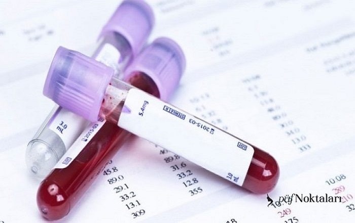 Một xét nghiệm máu đơn giản có thể giúp loại trừ ung thư phổi?